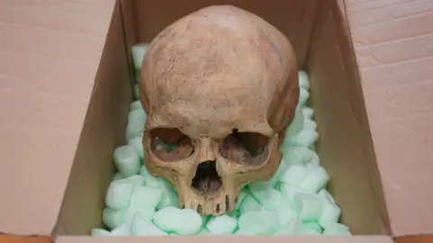 Historic Skull Returned to St Stephen's Cathedral After 60 Years