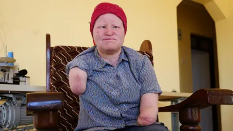 Fearing for Their Lives: The Perils of Albinism in Tanzania's Election Season